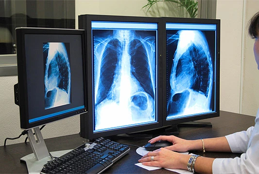 Edukacija za liječnike i inženjere radiologije