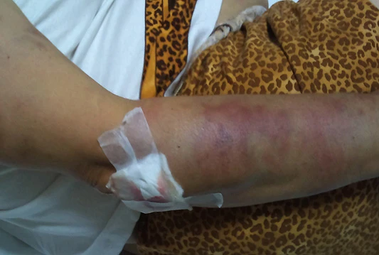 Obitelj tvrdi: Policija pokazala brutalnost; PU Mostar: Nije bilo prekoračenja ovlasti