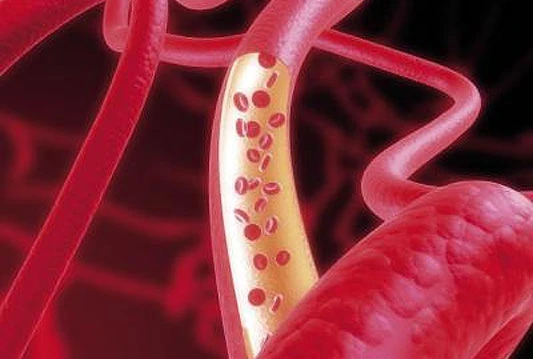 Verbalna sugestija može promijeniti promjer srčanih arterija