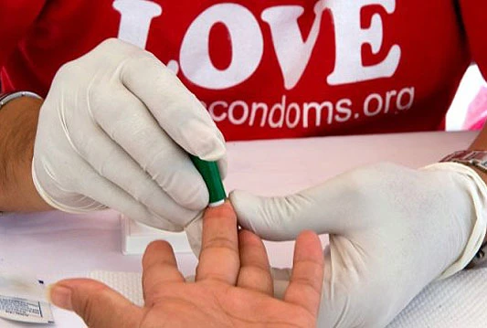 Anonimno, besplatno testiranje na HIV sutra od 8 do 20