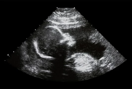 Već za tri godine bebe će moći imati tri biološka roditelja