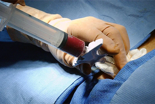 Banka koštane srži prvi korak za osnivanje transplantacijskog centra u BiH