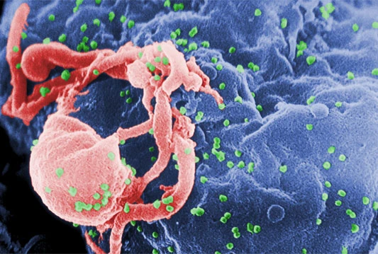 Je li ovo lijek? Još dva muškarca oslobođena virusa HIV!