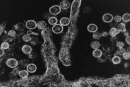 Smrtonosni hantavirus odnio dva života u kampu u Kaliforniji