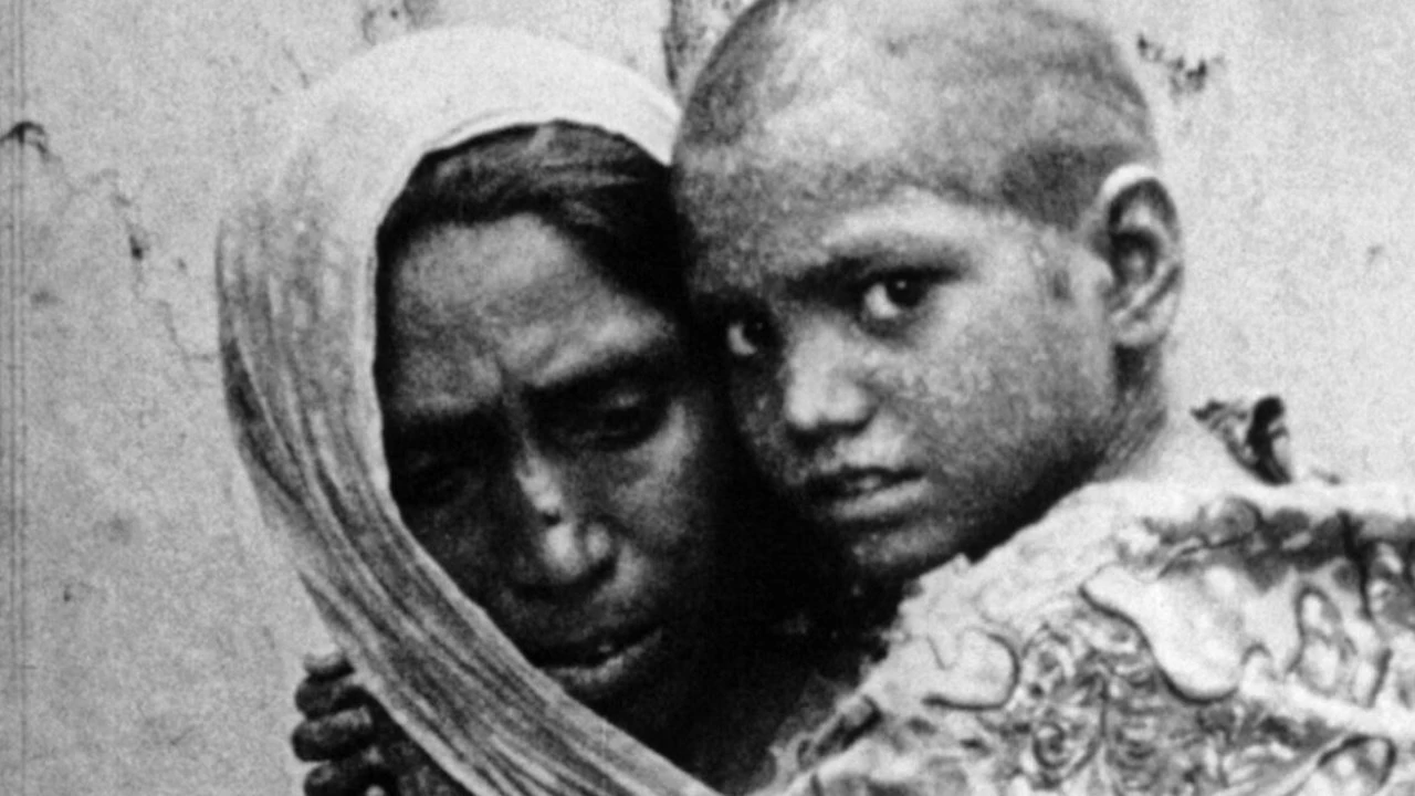 Variola: Jedina zarazna bolest koju je znanost iskorijenila