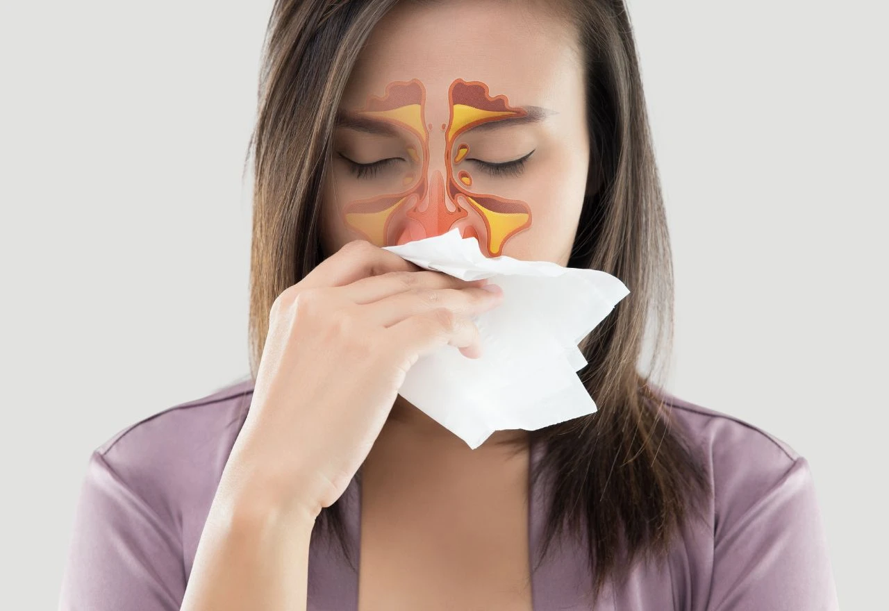 Akutni sinusitis: Koji su simptomi i najbolji tretmani za oporavak