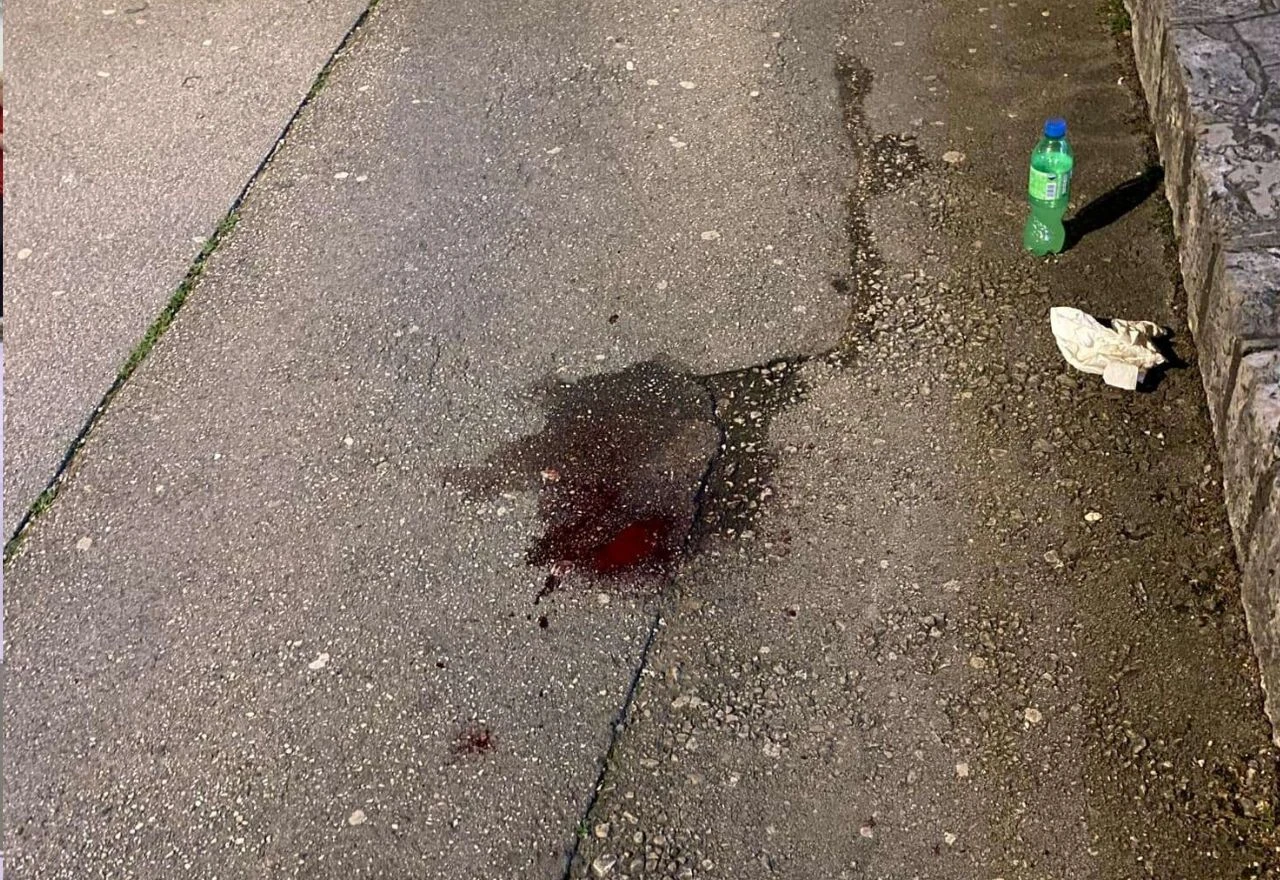 Pad s romobila u Mostaru: Dijete s ozljedama primljeno u bolnicu