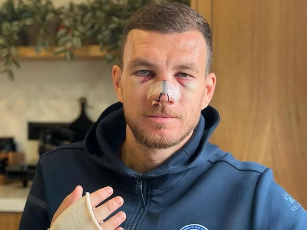 Džeko ostavio poruku, javio se i Balotelli
