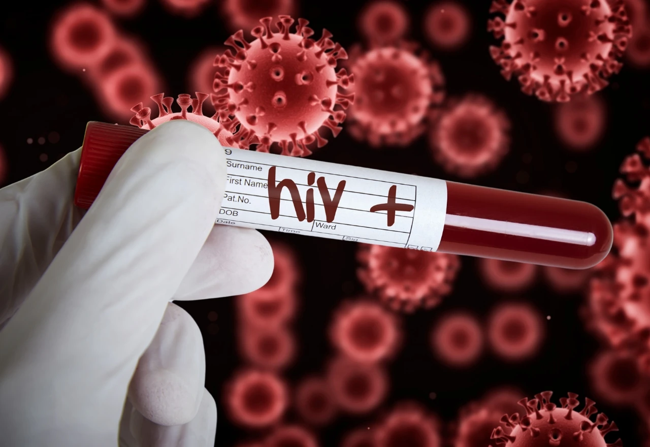 Broj HIV slučajeva u BiH je daleko veći nego što je registrirano