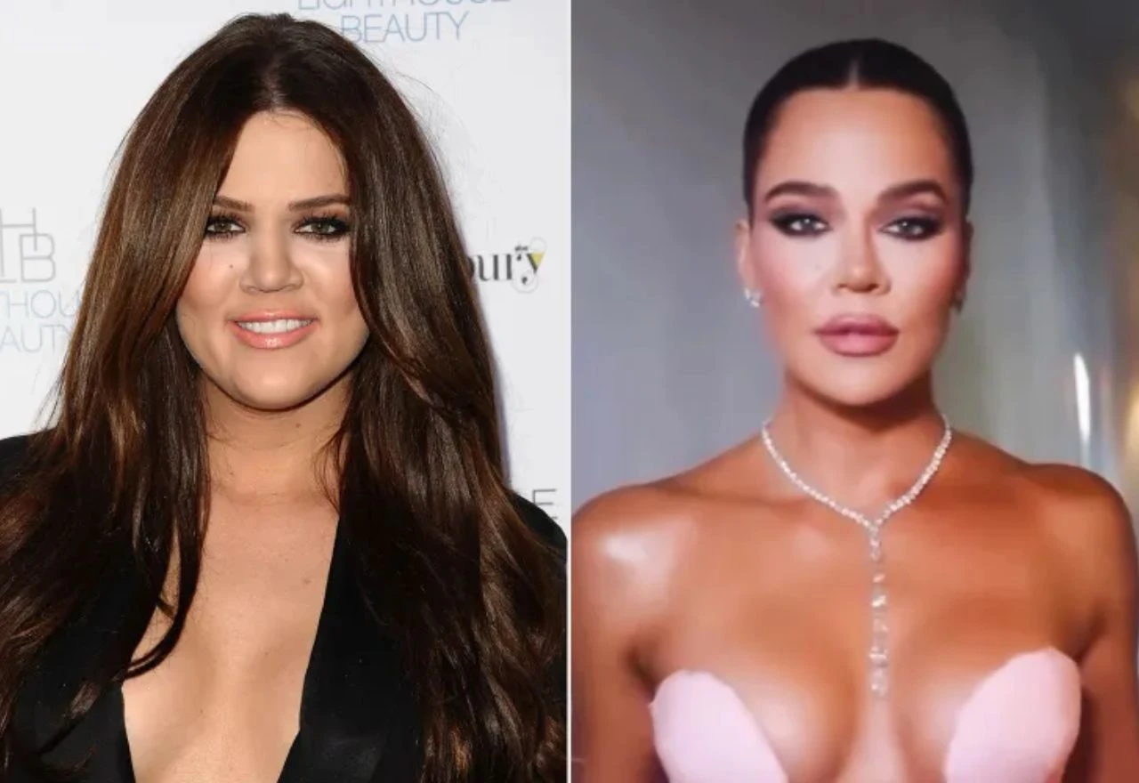 Khloé Kardashian otkriva svoje estetske zahvate – evo što je sve napravila