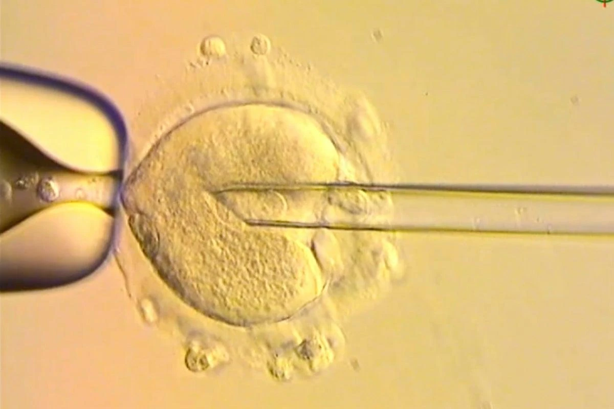 Rođeno osmero zdravih beba uz pomoć revolucionarne IVF metode