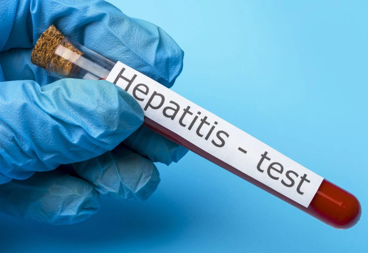 Baljić: Testiranje ključno, hepatitis može napredovati bez simptoma i uzrokovati cirozu