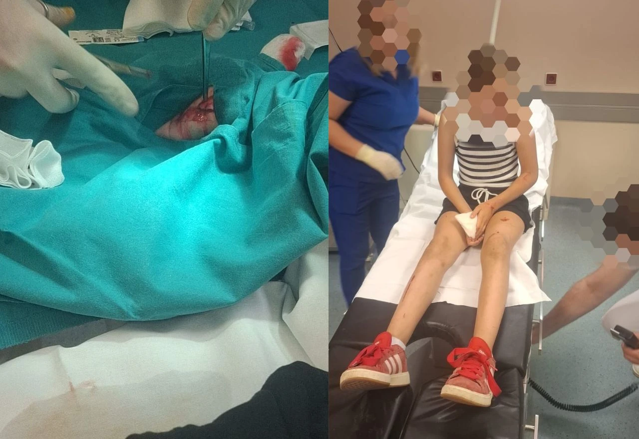 Djevojčica ozlijeđena u naletu električnog romobila u Mostaru: Kada će se nešto promijeniti?