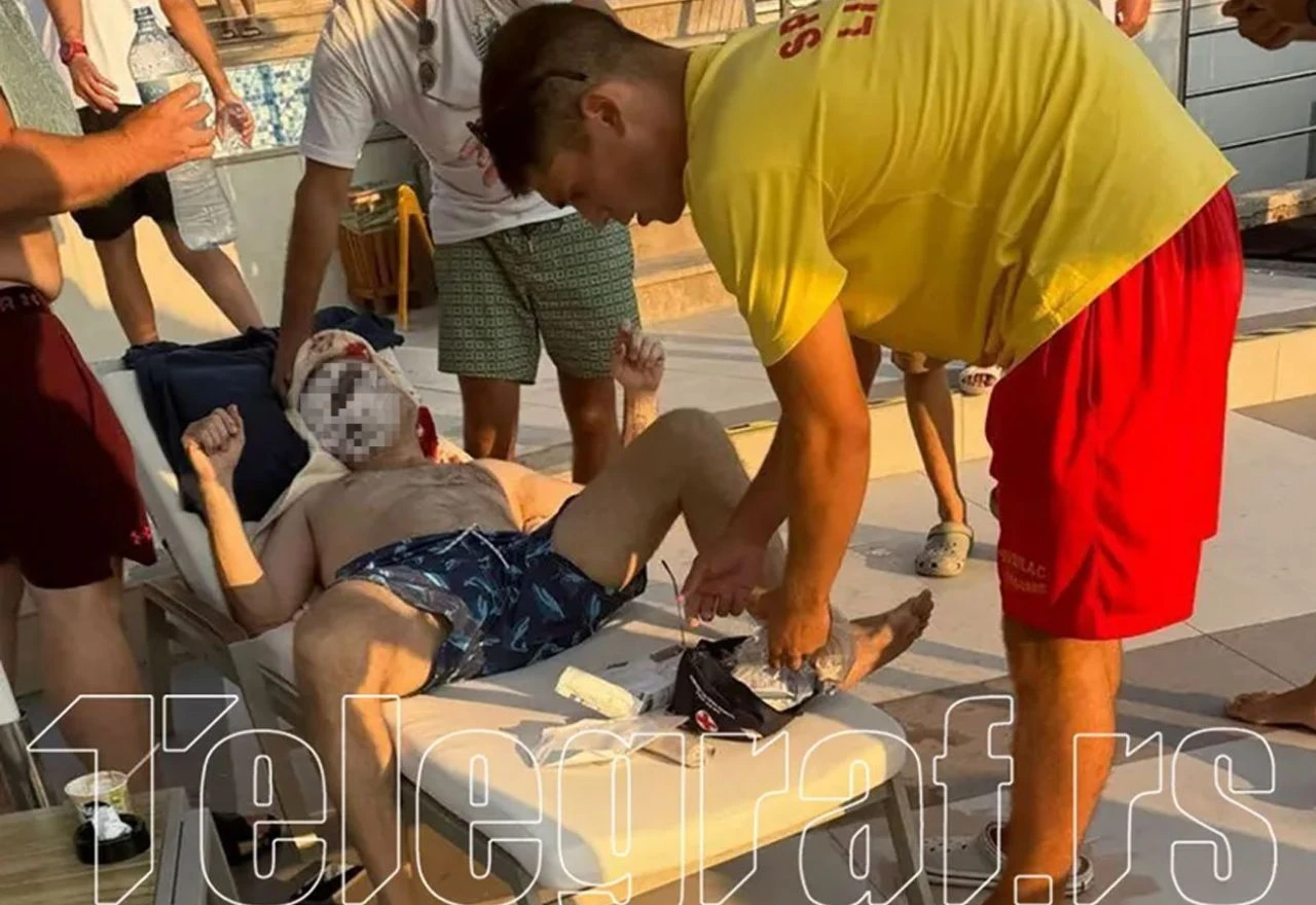 Atentat u Budvi: Ranjen u glavu na bazenu hotela