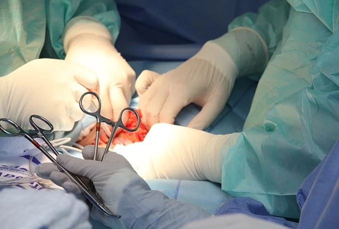 Povijesni zahvat u KBC-u Split: Prva balonska angioplastika plućnih arterija