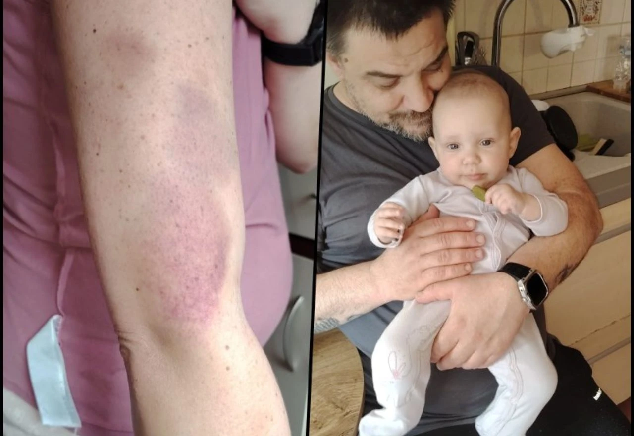 Nakon teških operacija i zdravstvenih problema, obitelji Ujdur je potrebna vaša pomoć