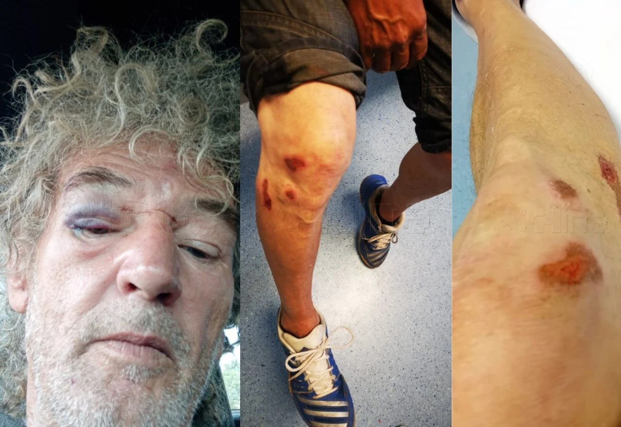 Splićanin prijavio policajce iz Ljubuškog zbog upada u kuću i brutalnog premlaćivanja