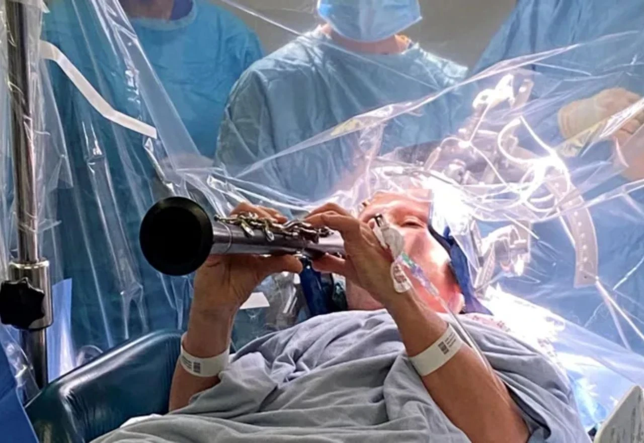 VIDEO | Žena s Parkinsonovom bolesti svirala klarinet tijekom operacije mozga