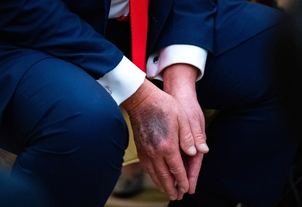 Liječnici sigurni: Trump je i dalje iznimnog zdravlja