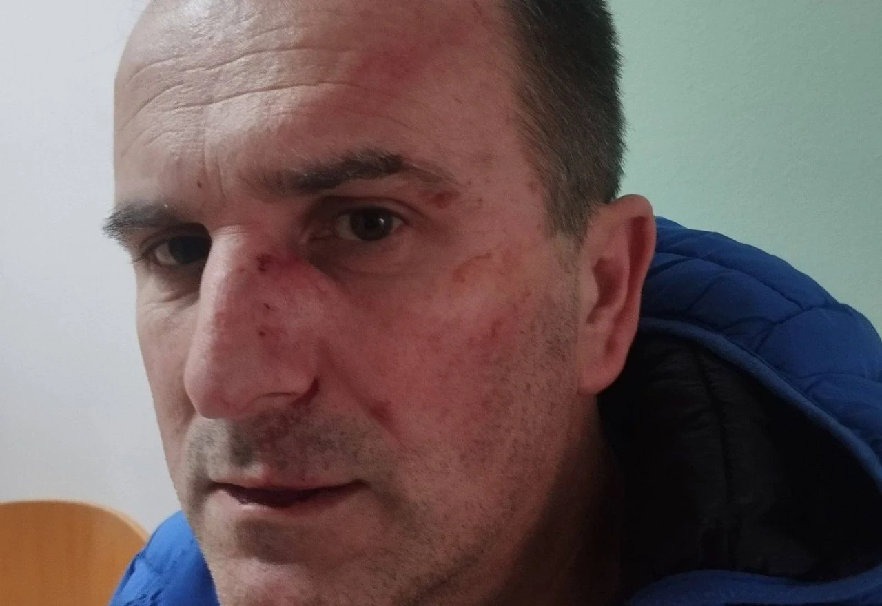 Razotkrio aferu s nabavkom opreme za vrtić u BiH, a zatim pretučen