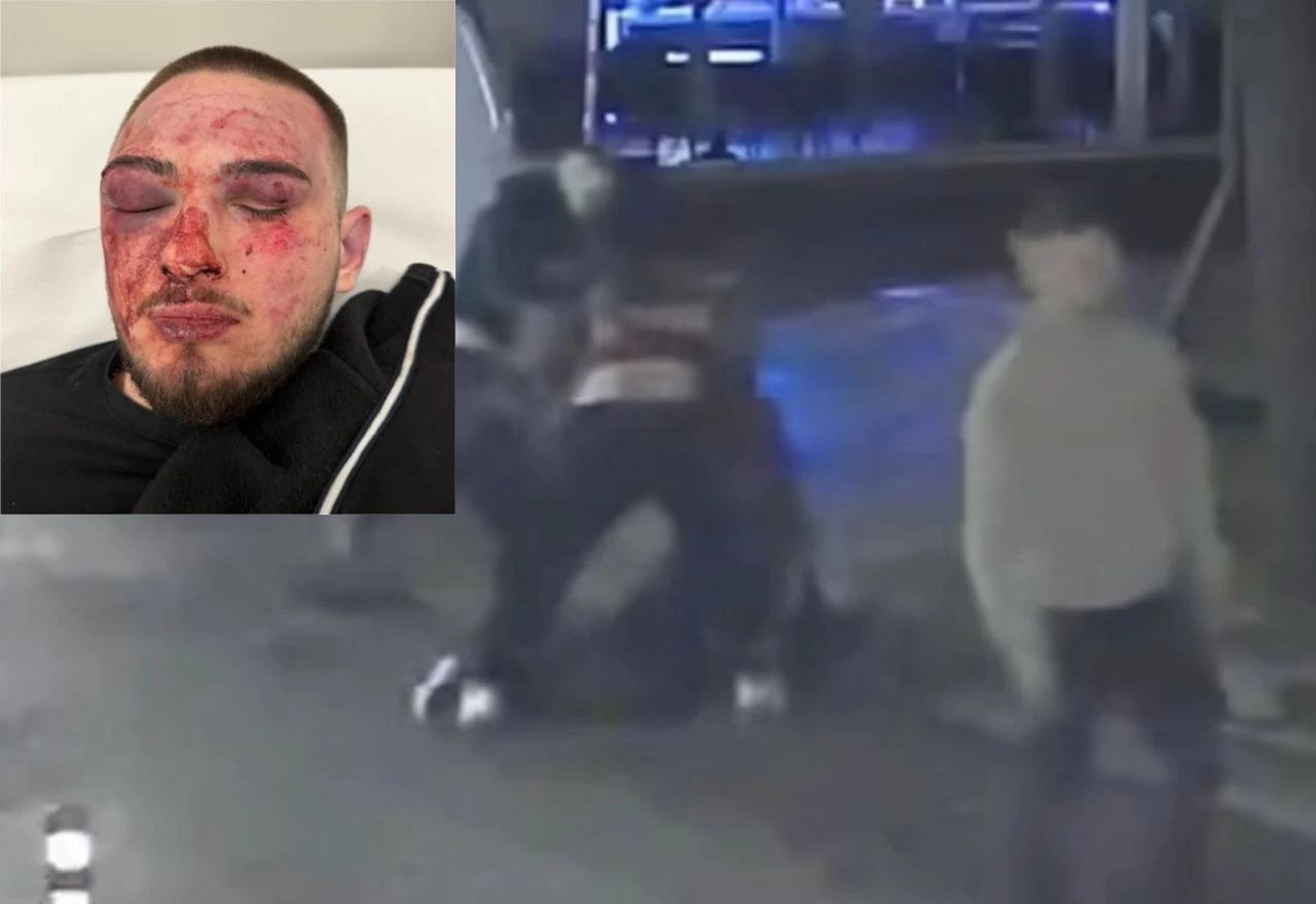 Maloljetnik brutalno pretučen u centru Rijeke, jedan napadač uhićen