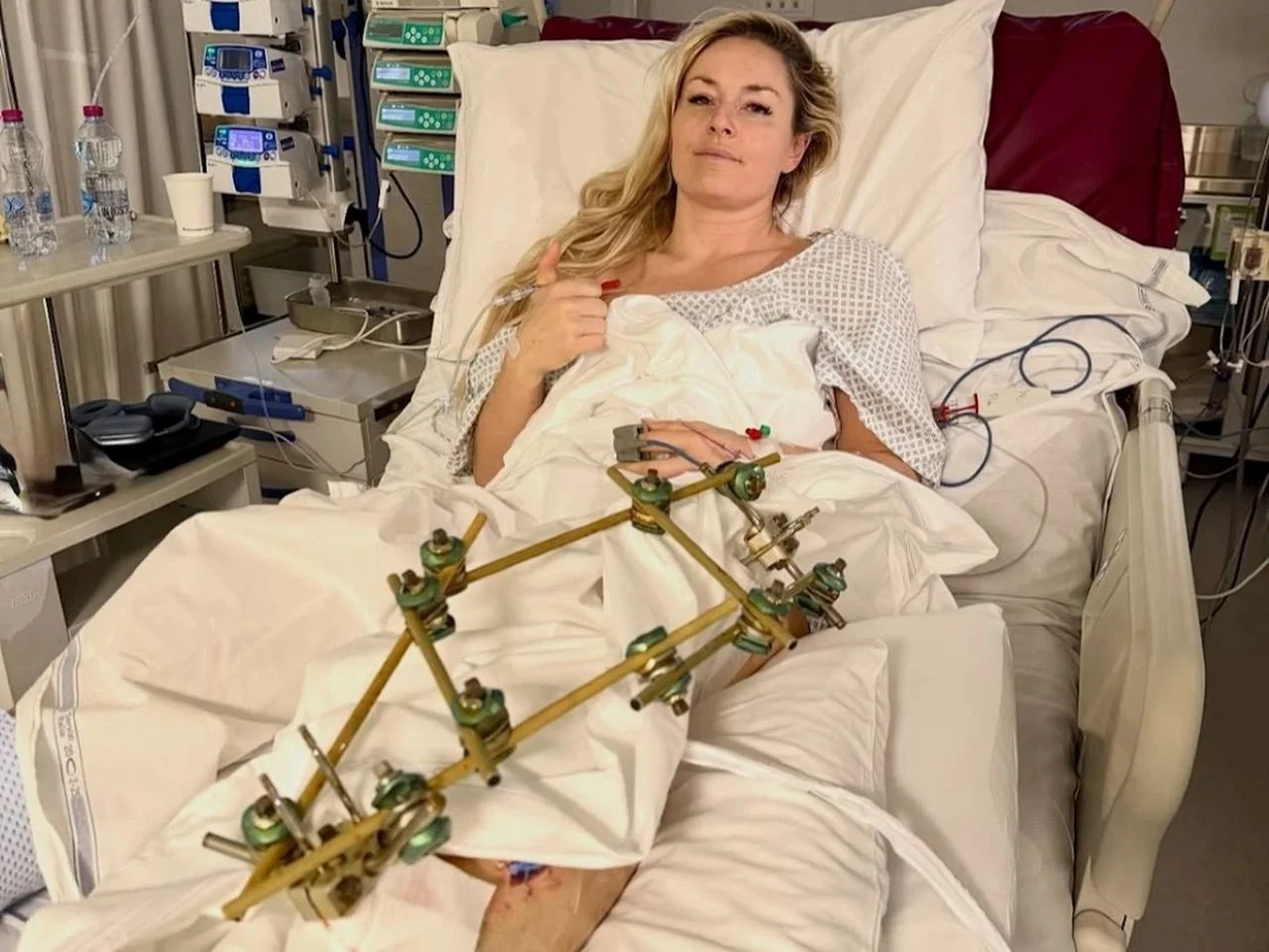 Vonn: Čeka me još jedna operacija, pa onda vrlo vjerojatno još jedna