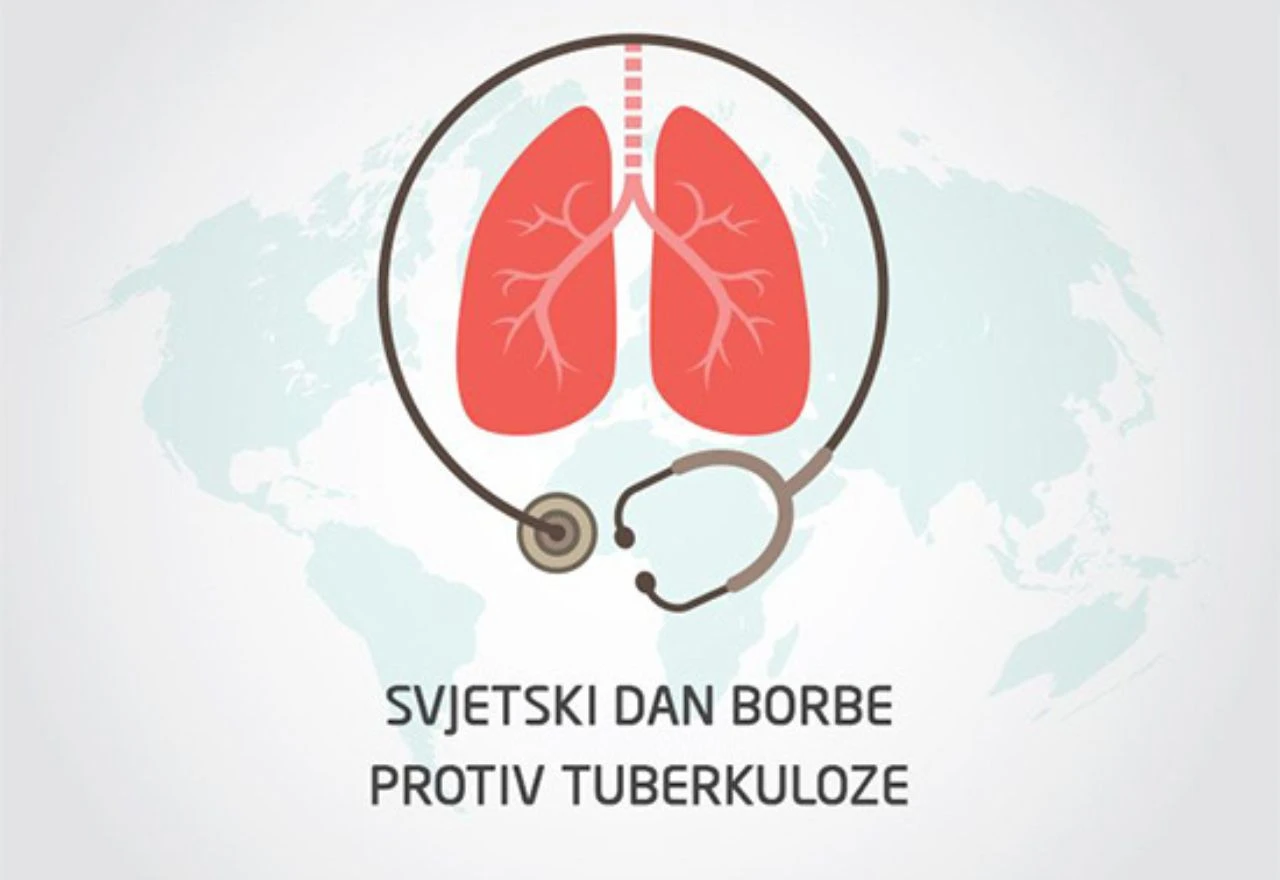 Svjetski dan borbe protiv tuberkuloze: Zašto bolest još nije iskorijenjena?