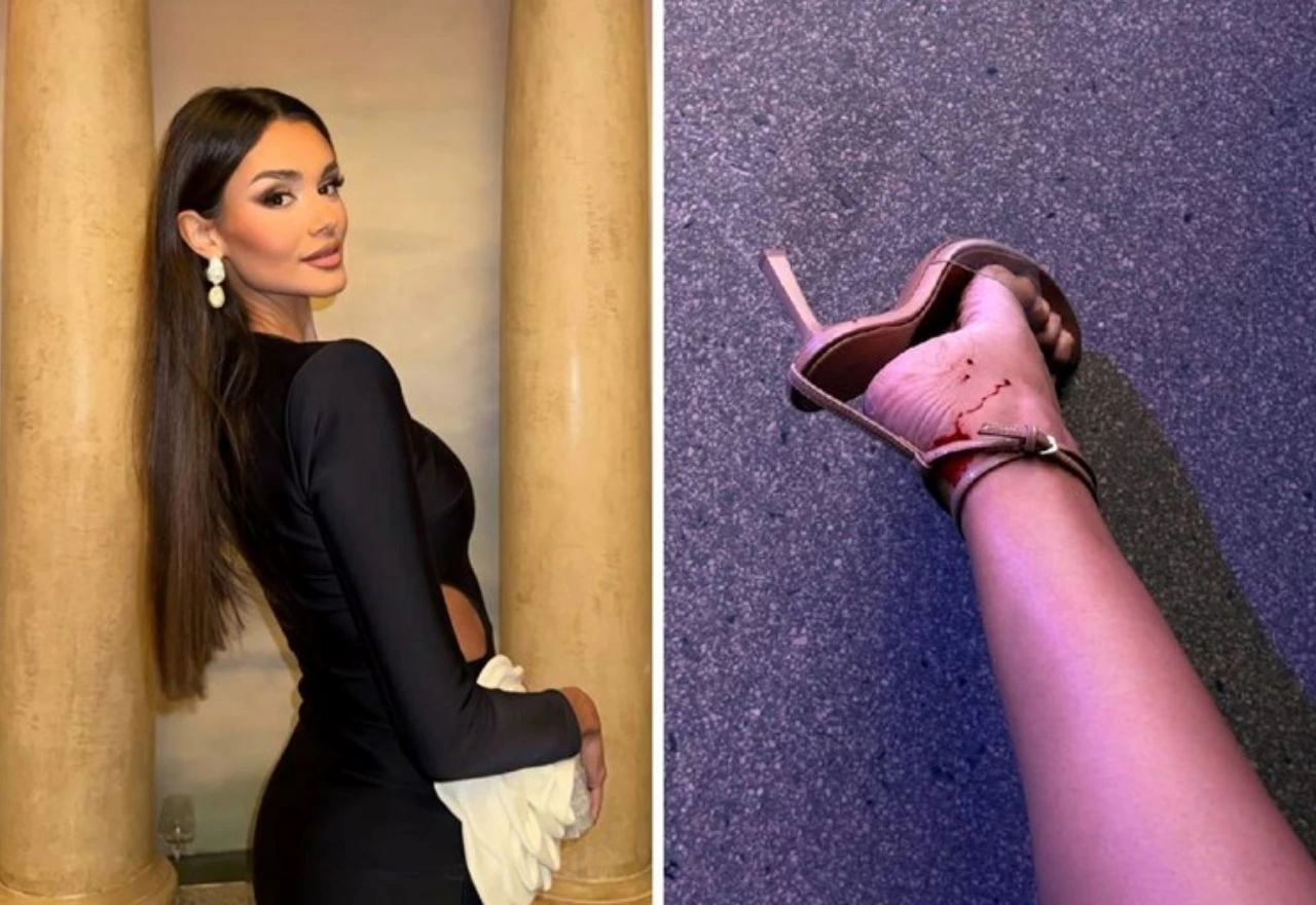 Miss Universe Hrvatske pokazala ružnu stranu glamura: "Stopala su mi izranjavana"