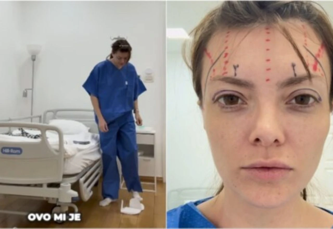 Ella Dvornik pokazala lice nakon estetske operacije: "Nisam htjela izgledati zategnuto nego svježije"
