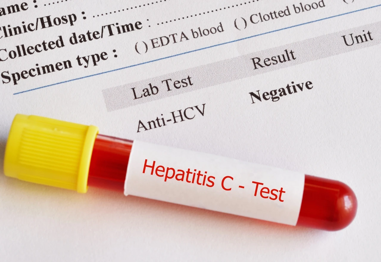 Besplatno testiranje studenata na HIV i hepatitis na Kampusu SUM-a
