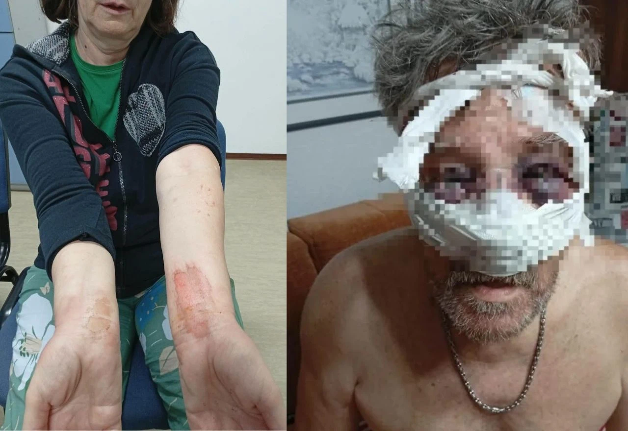 Pet ozlijeđenih u masovnoj tučnjavi u Tuzli: Uhićena žena, pronađen pištolj