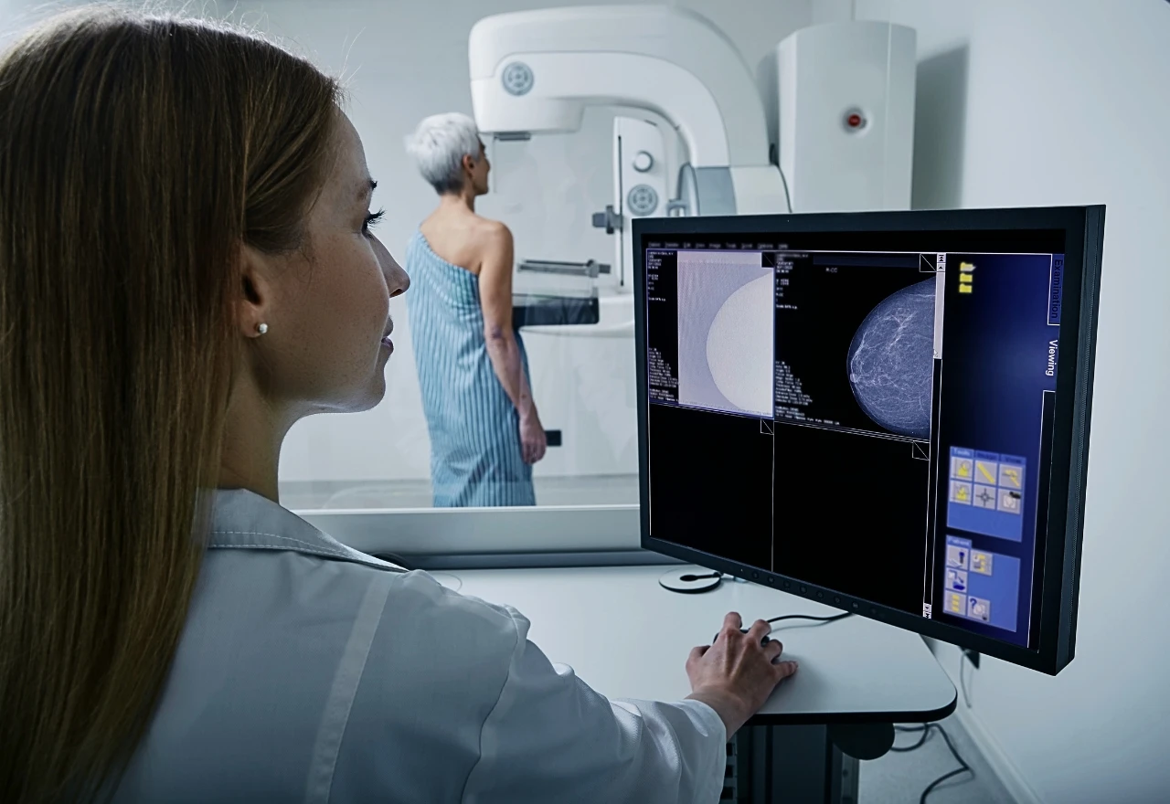 Ženama HNŽ-a omogućena online prijava na besplatnu mamografiju
