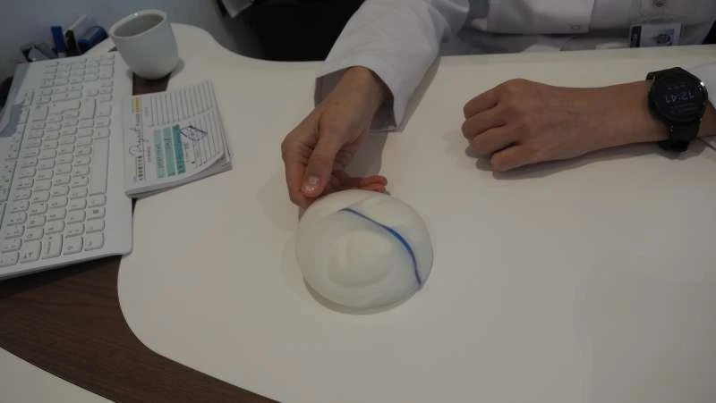 Implantati ili vlastito tkivo: Kako izgleda rekonstrukcija dojke nakon karcinoma?