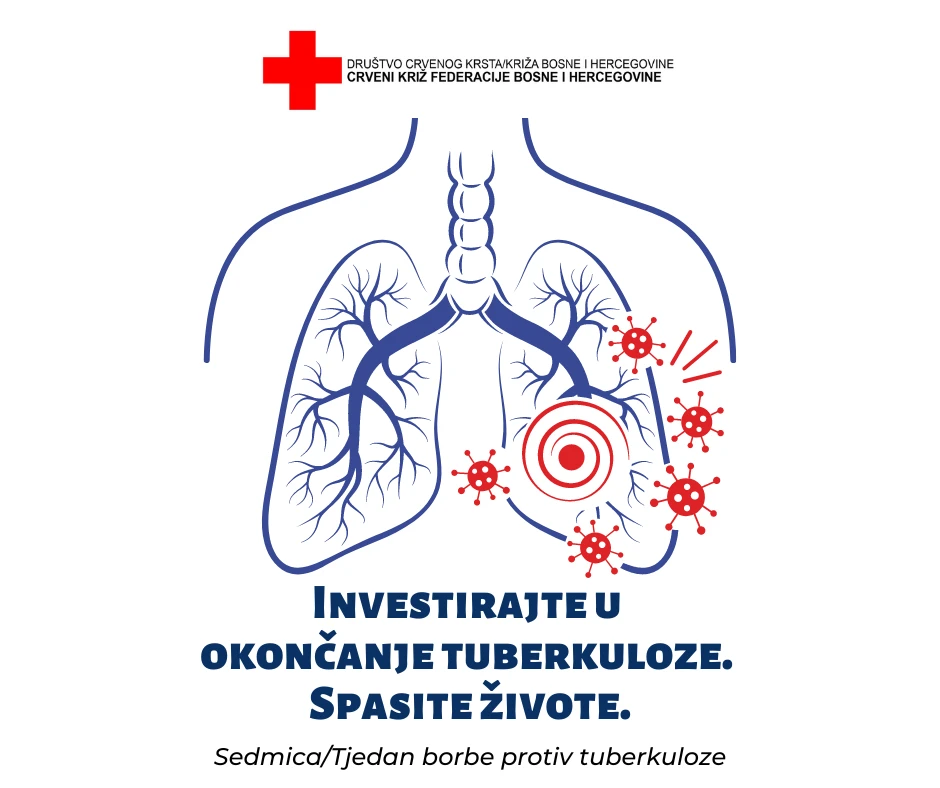 Crveni križ FBiH obilježava Tjedan borbe protiv tuberkuloze