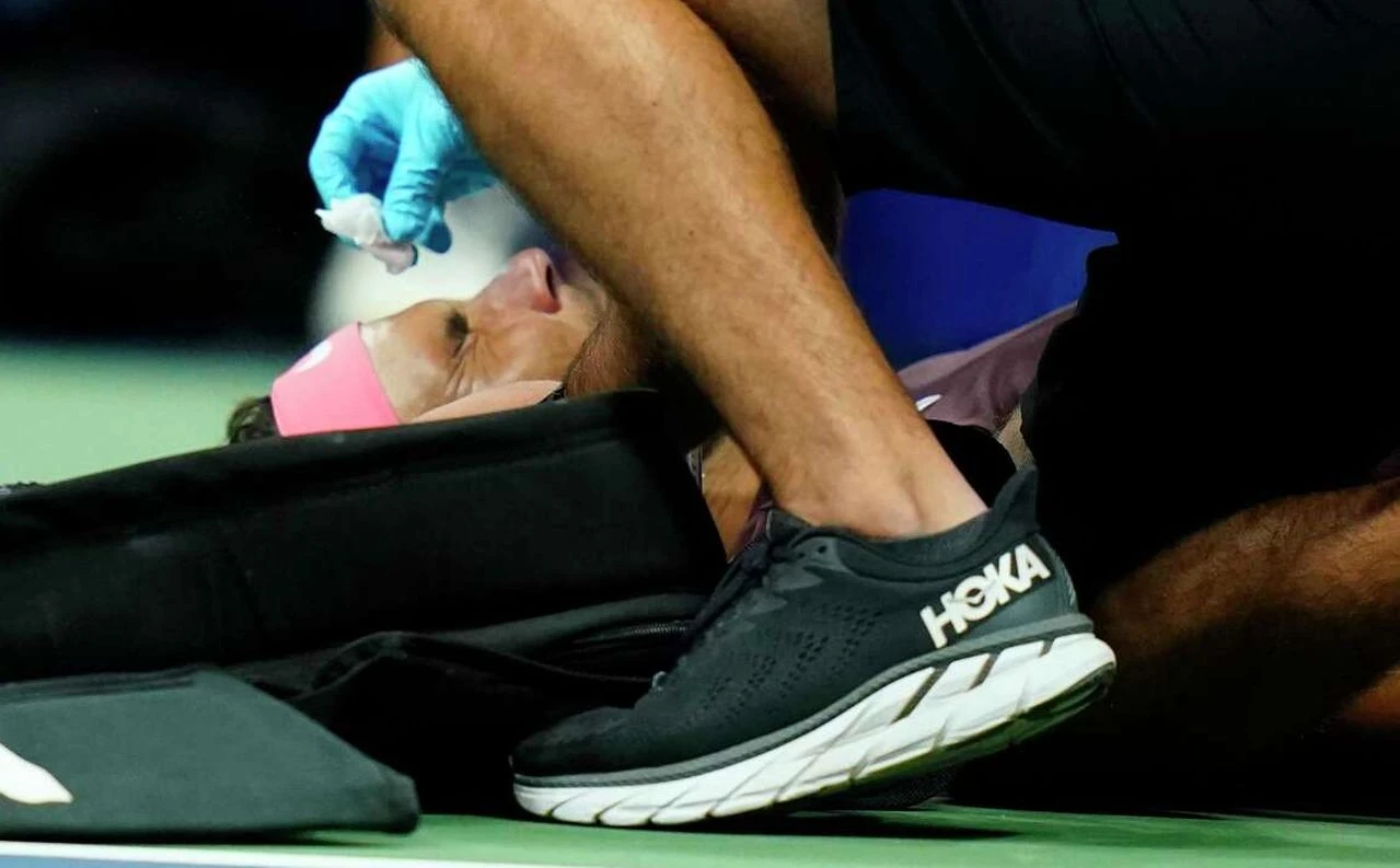 Nadal sam sebi razbio nos