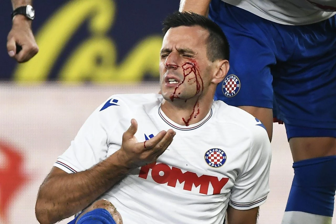 Kalinić teško stradao
