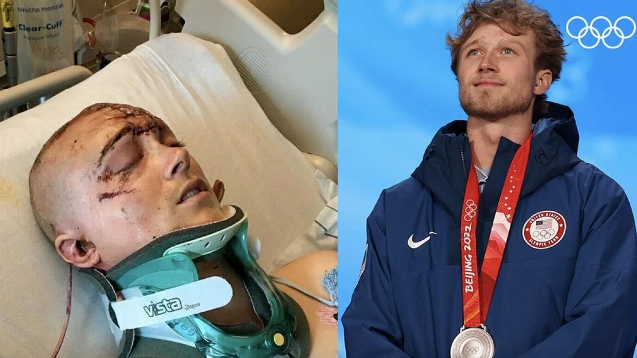 Imao je 30 prijeloma lubanje sada ima i medalju 