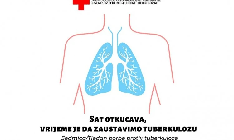 Tuberkuloza jedan od vodećih globalnih zdravstvenih problema