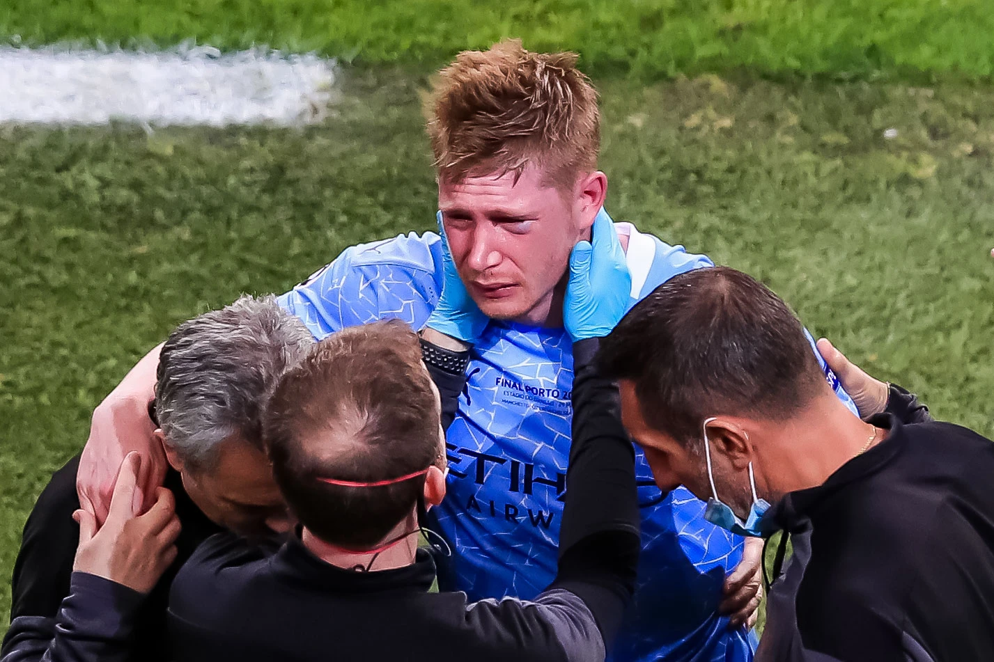 De Bruyne se javio nakon nokauta: Ima frakturu nosa i jagodične kosti