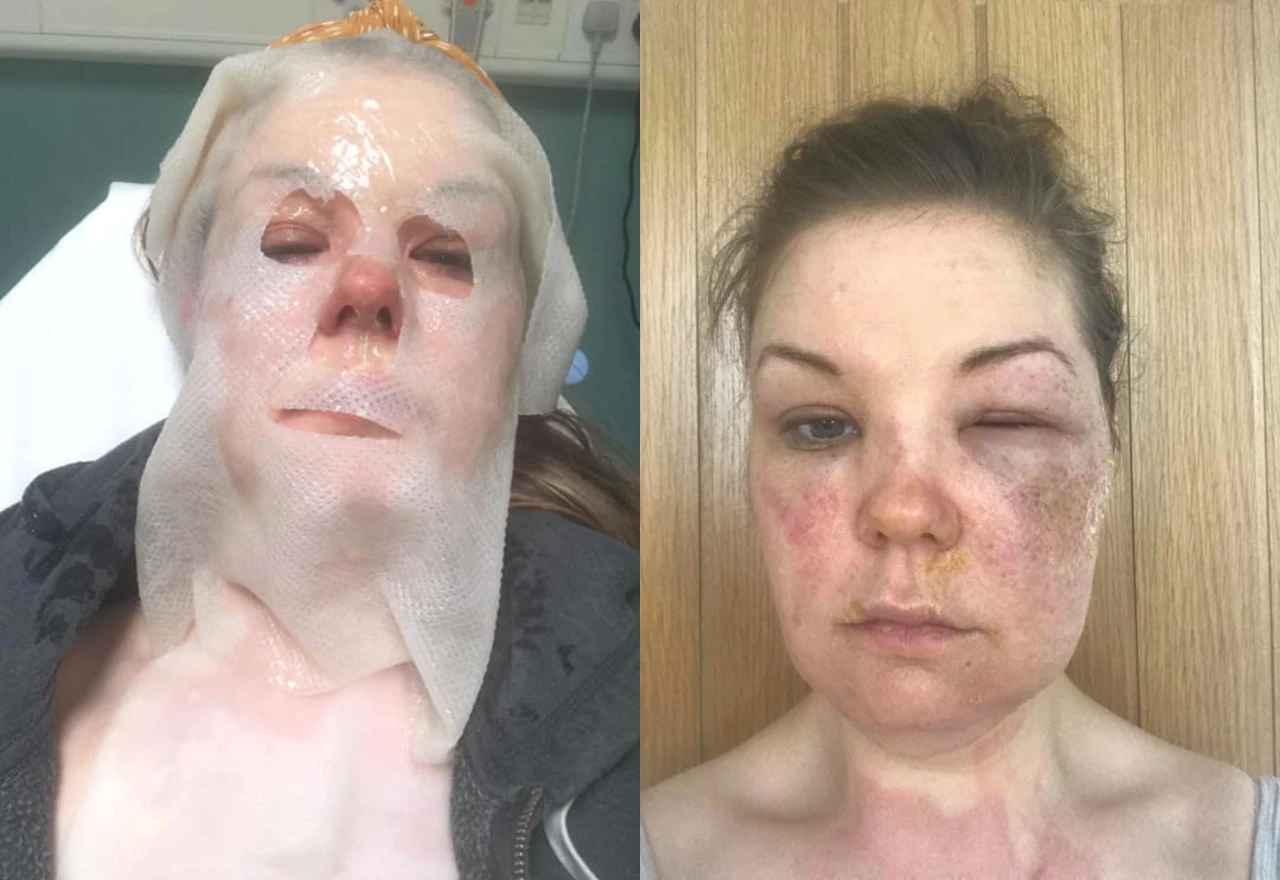 Zbog kulinarskih savjeta s TikToka završila u bolnici