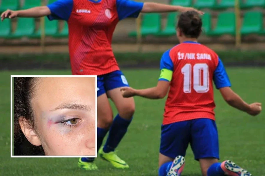 VIDEO | Brutalna tučnjava bh. igračica: Jedna završila s potresom mozga